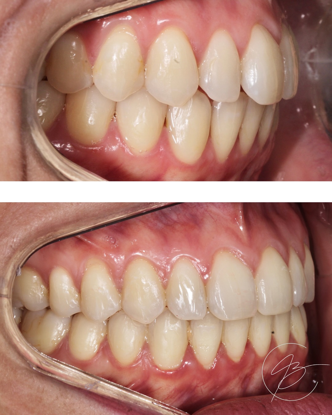 Resultado de tratamento odontológico — antes e depois