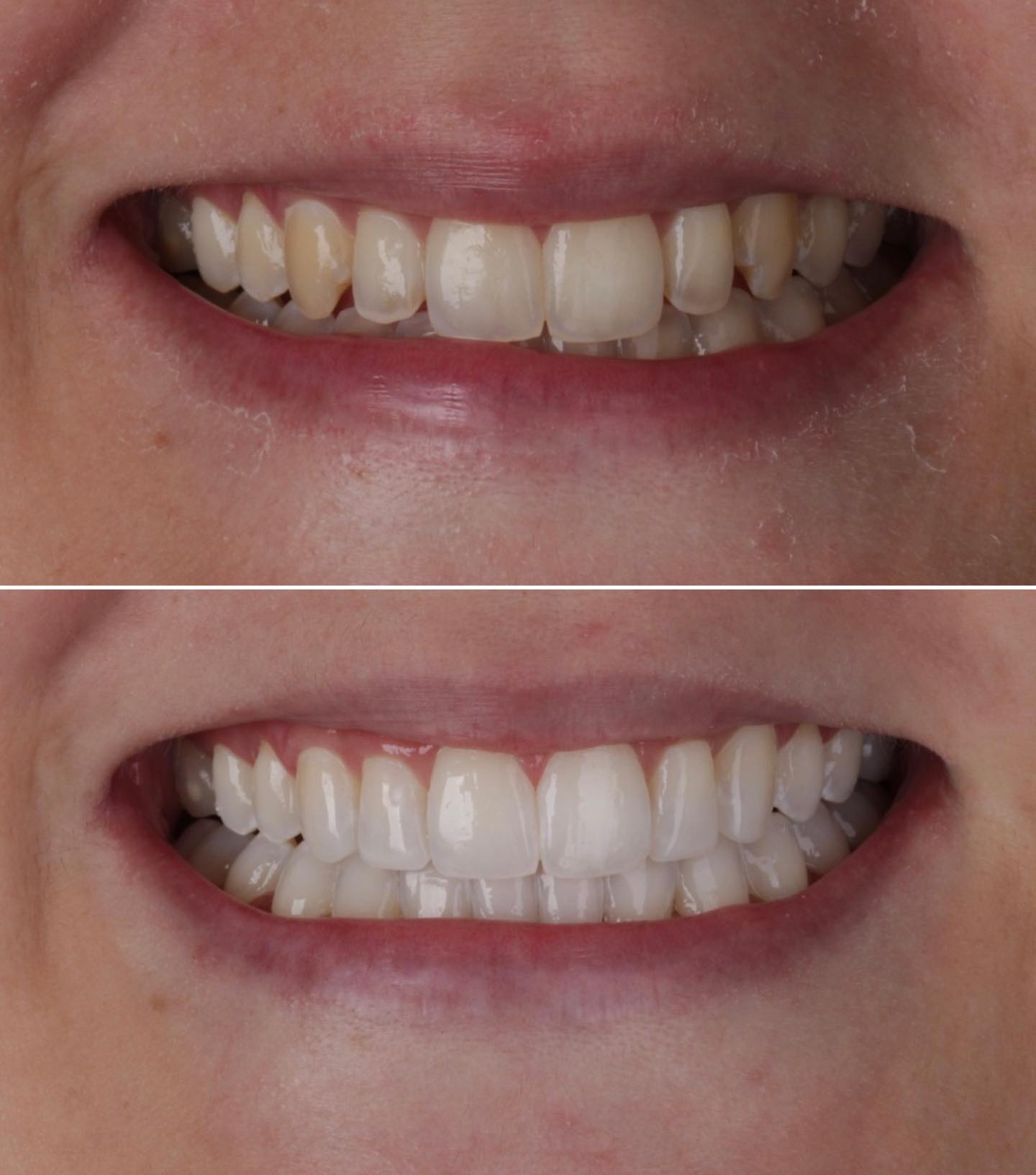 Resultado de tratamento odontológico — antes e depois